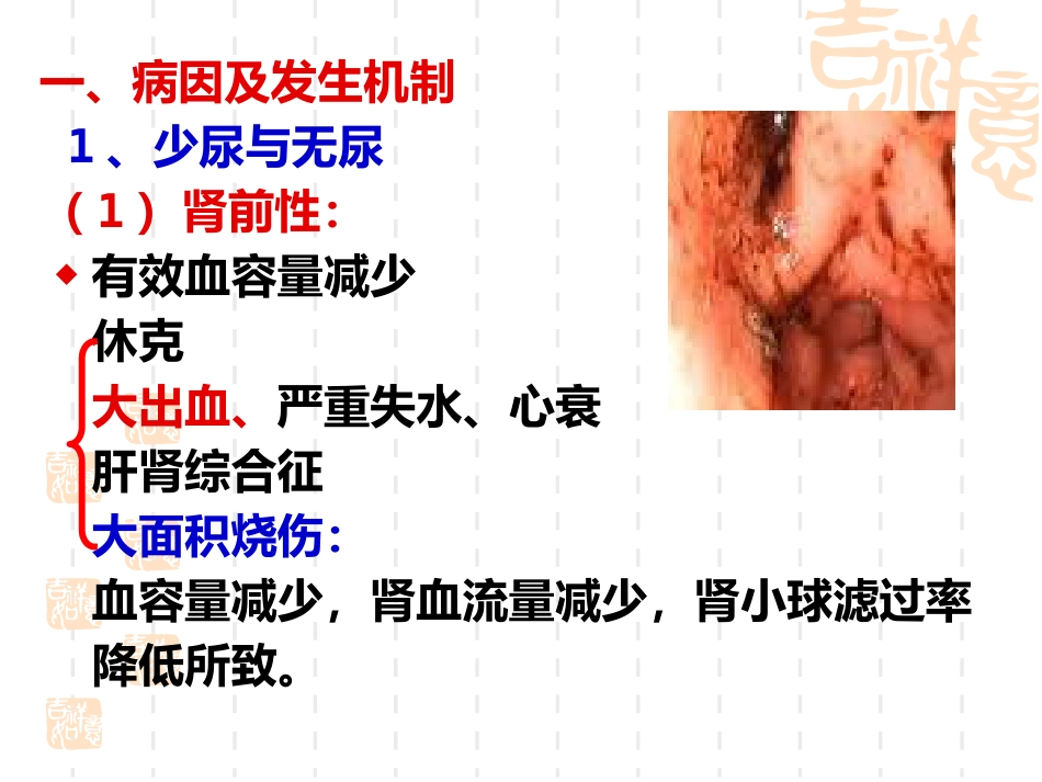 诊断学少尿、无尿、多尿(讲座)_第4页