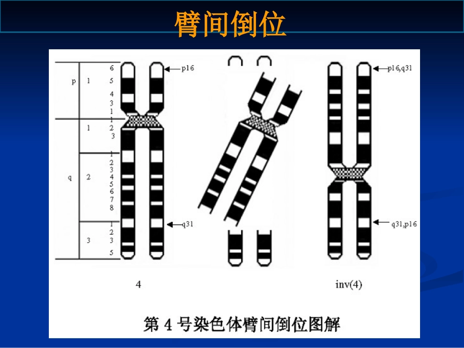 染色体病诊断与咨询讲座_第15页