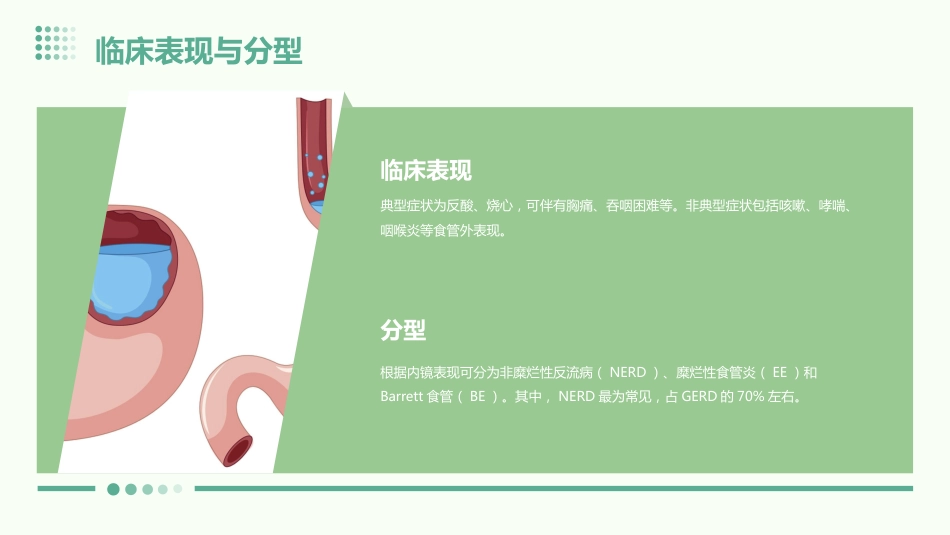 《中国胃食管反流病诊疗规范》(2023版)解读PPT课件_第9页