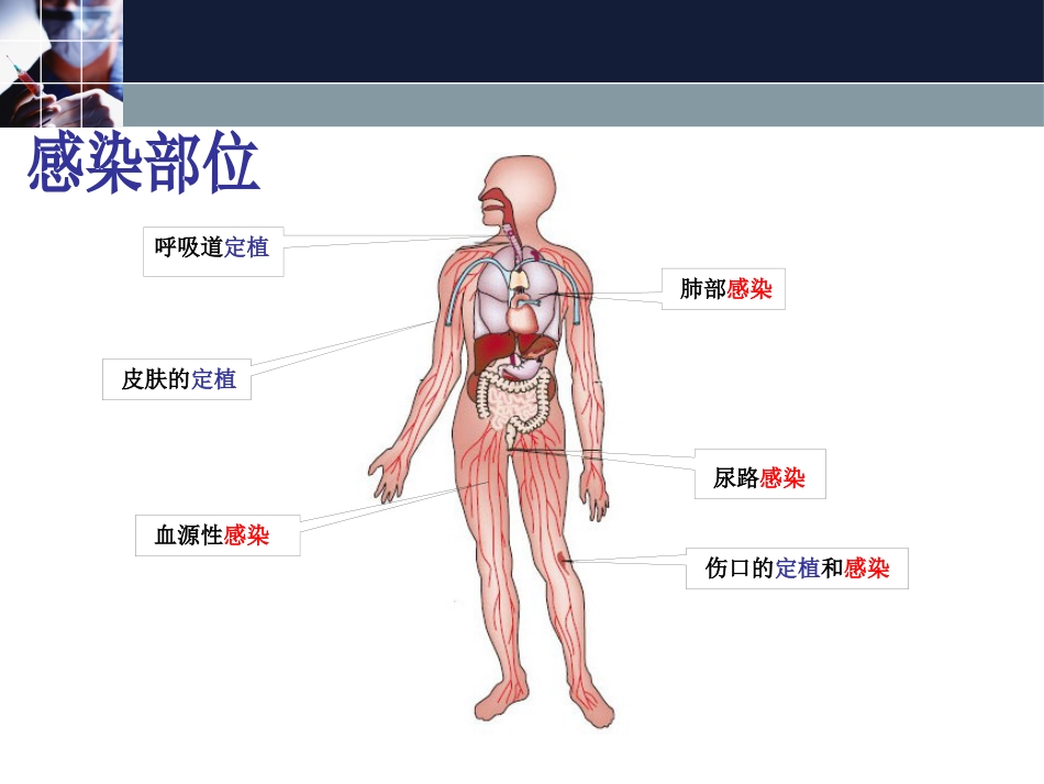 2016多重耐药菌感染管理_第12页