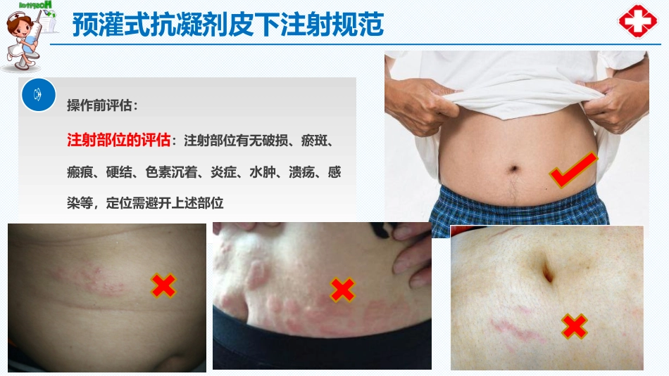 预灌式抗凝剂皮下注射规范_第11页