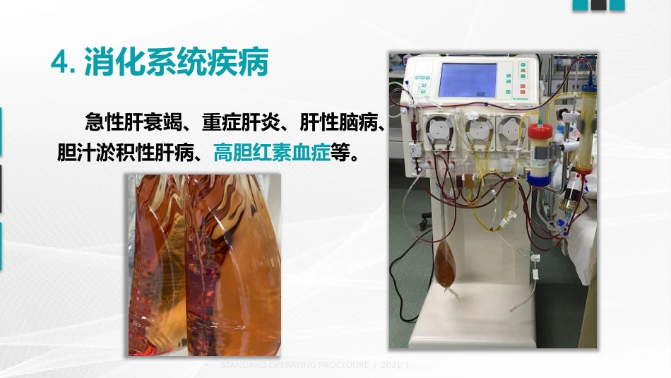 血浆置换标准操作规程(国家卫健委2021版)_第11页