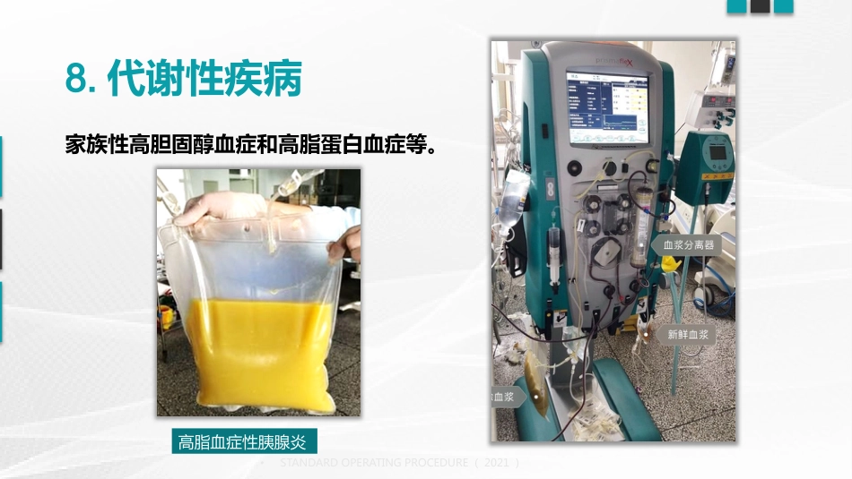 血浆置换标准操作规程(国家卫健委2021版)_第15页