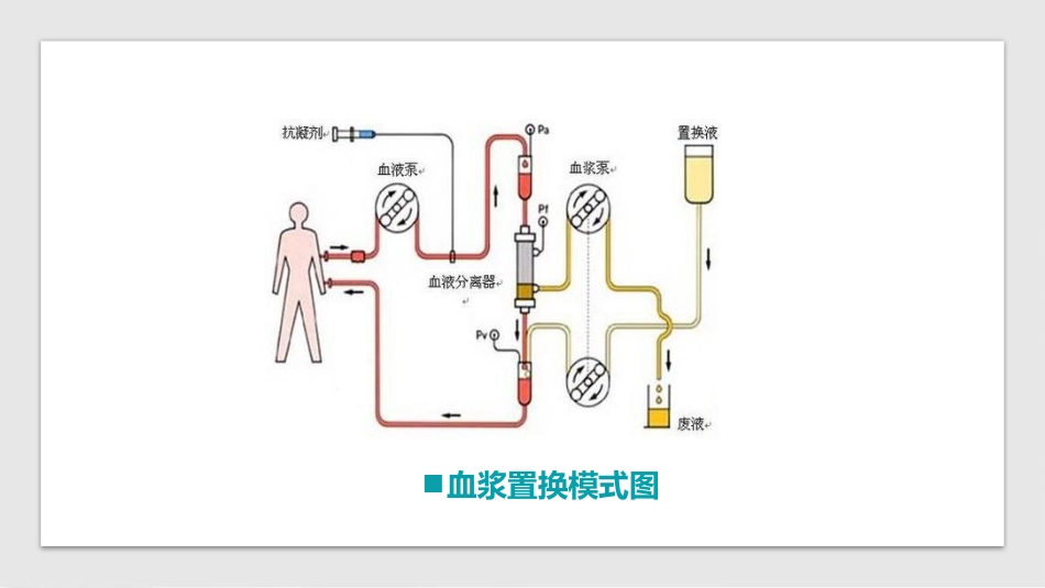 血浆置换标准操作规程(国家卫健委2021版)_第5页