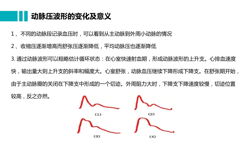 桡动脉穿刺置管操作与压力监测_第14页