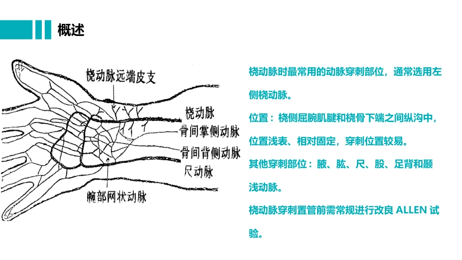 桡动脉穿刺置管操作与压力监测_第3页