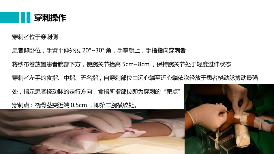 桡动脉穿刺置管操作与压力监测_第7页