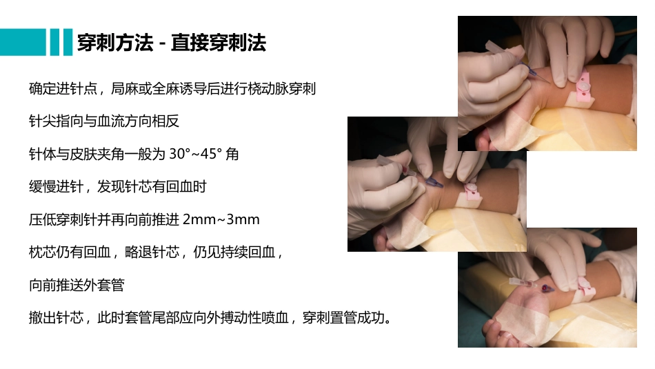 桡动脉穿刺置管操作与压力监测_第8页