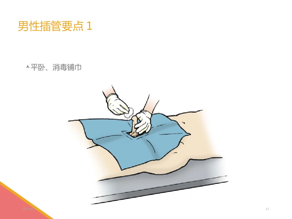 男性导尿术-PPT课件_第11页