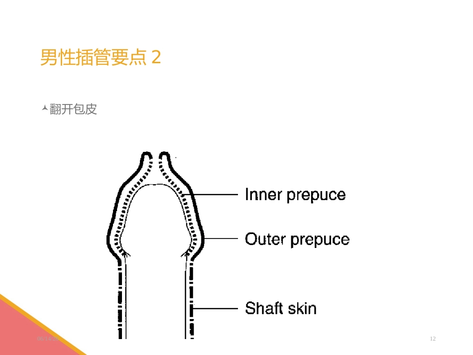 男性导尿术-PPT课件_第12页
