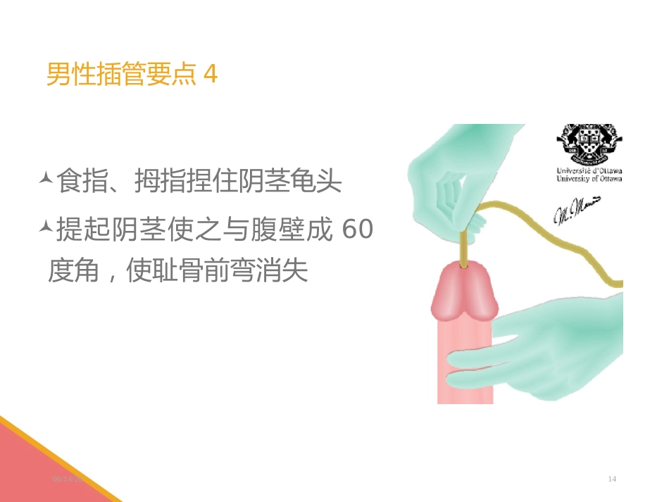 男性导尿术-PPT课件_第14页