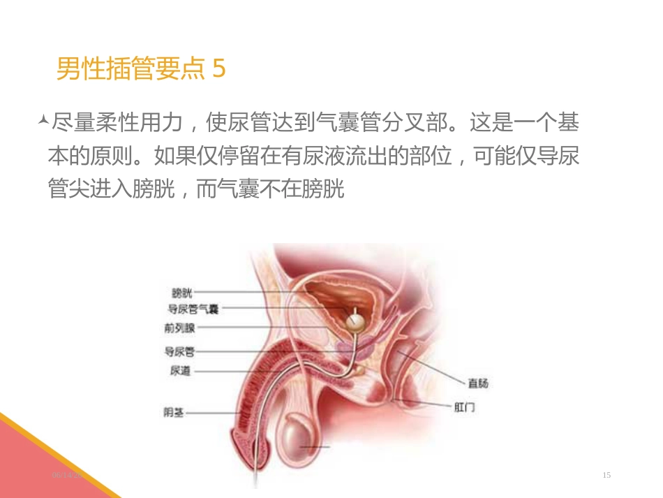 男性导尿术-PPT课件_第15页
