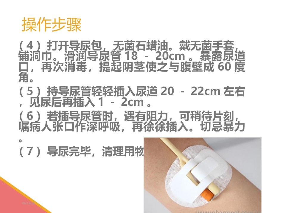 男性导尿术-PPT课件_第7页