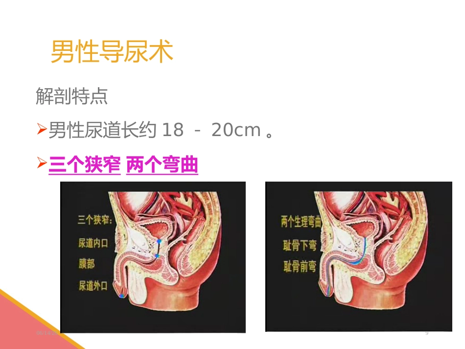 男性导尿术-PPT课件_第9页