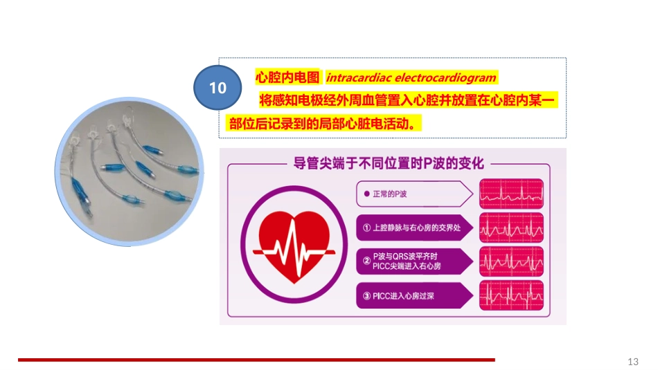 静脉治疗护理技术操作规范标准解读_第13页