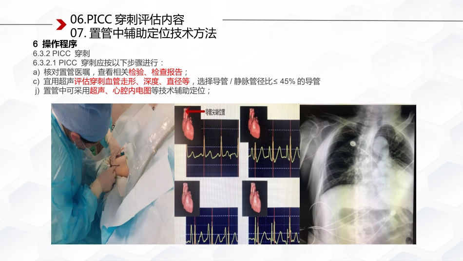 静脉治疗护理技术操作标准解读_第11页