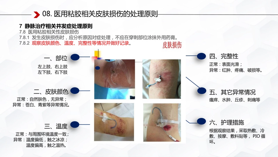 静脉治疗护理技术操作标准解读_第12页