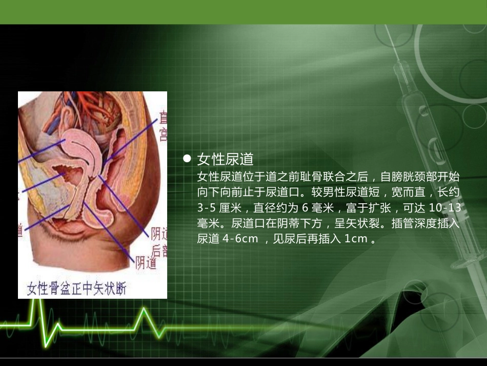 留置导尿的护理培训课件_第5页