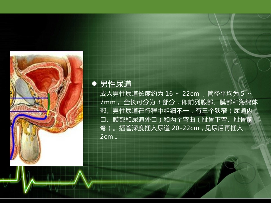 留置导尿的护理培训课件_第6页