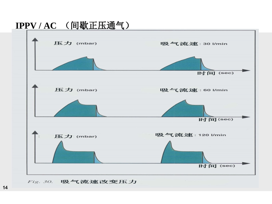 德尔格-Evita-4-呼吸机临床实用培训讲义(医院版)-_第14页
