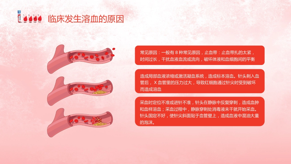 【医护教育】技能培训：发生溶血的防范措施培训_第5页
