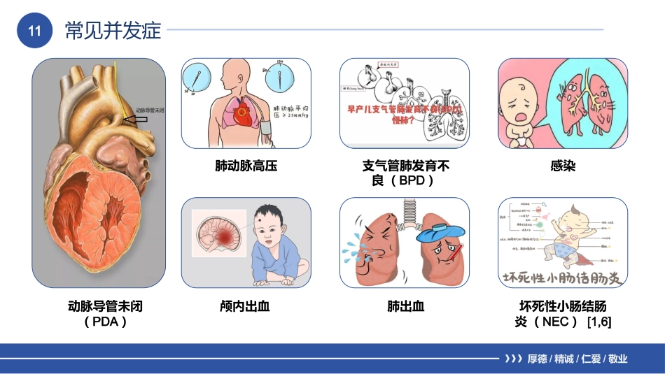 一例新生儿呼吸窘迫综合征的护理个案_第12页