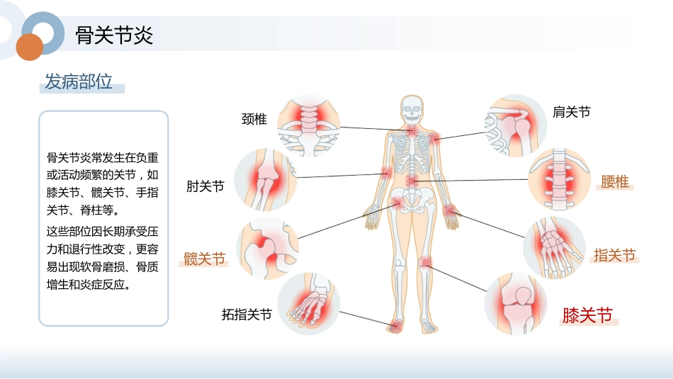 骨骼养护健康宣教讲座_第13页