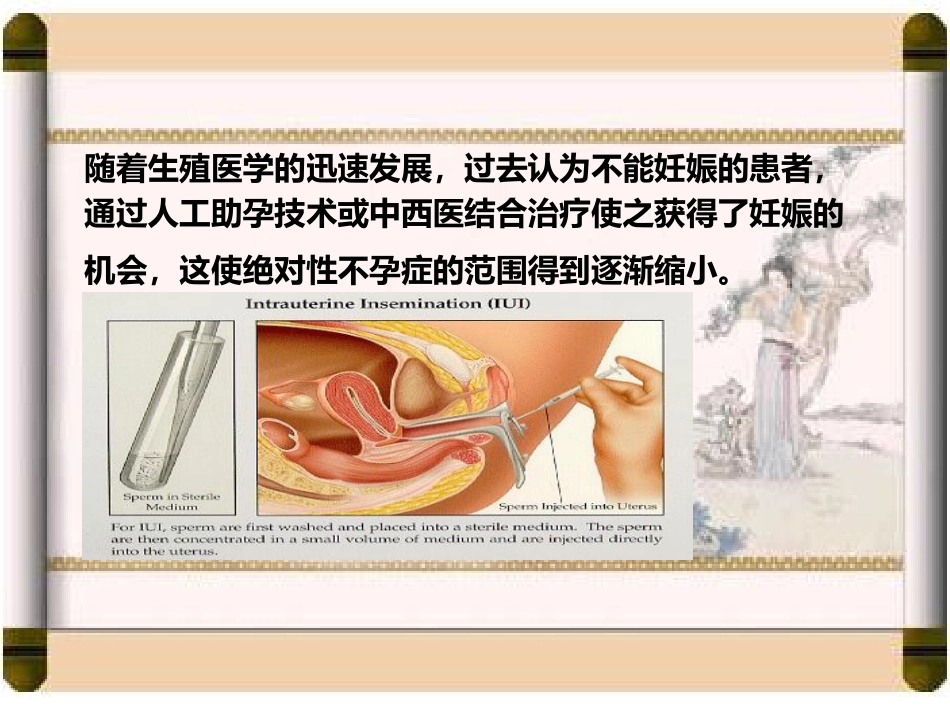 国家课程中医妇科学不孕症_第7页