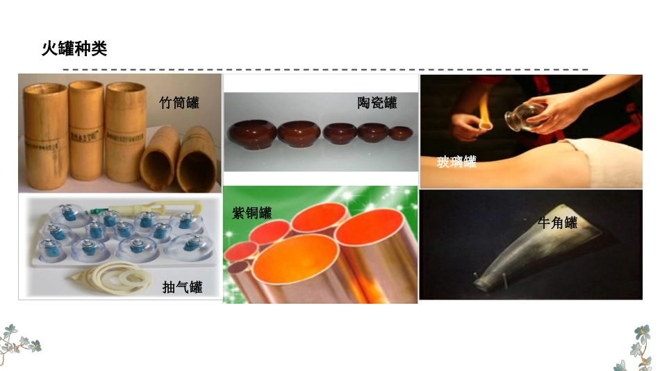 平衡火罐疗法PPT_第7页