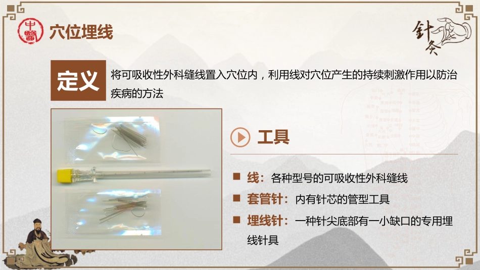 中医治疗：穴位埋线治疗单纯性肥胖_第15页