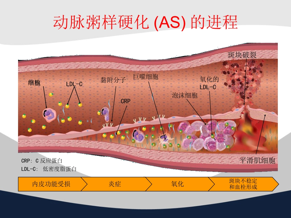 冠心病中西医诊疗ppt课件_第9页
