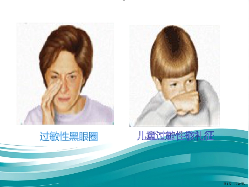 过敏性鼻炎的中医药防治_第6页