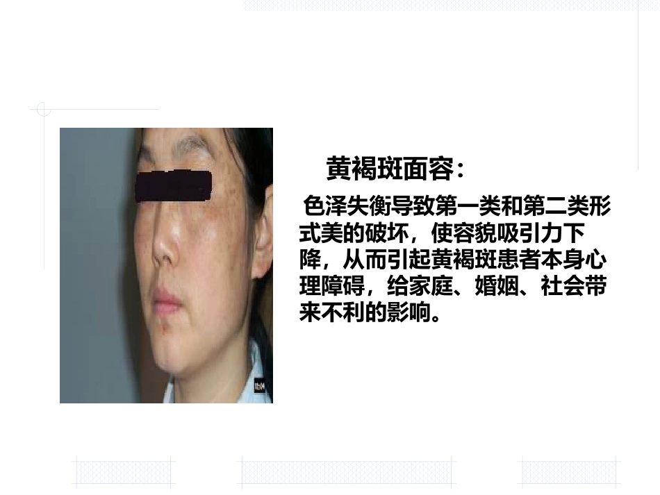 黄褐斑的中医药治疗_第5页