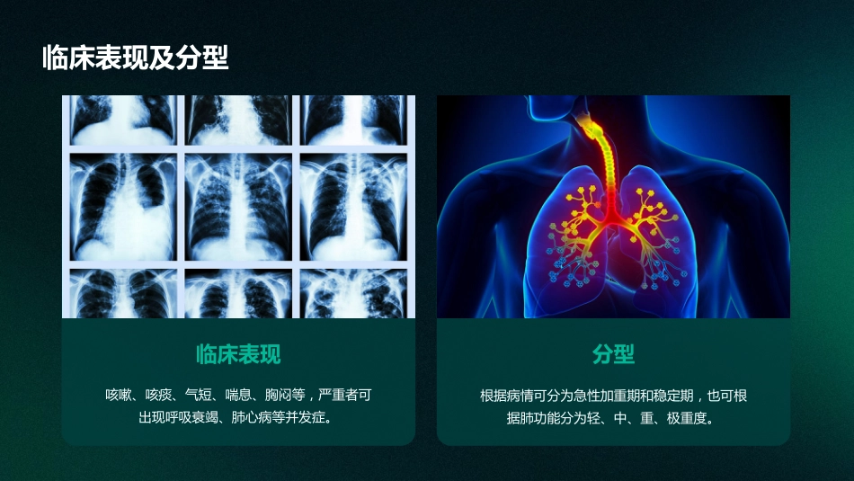 慢性阻塞性肺疾病的中医护理_第5页