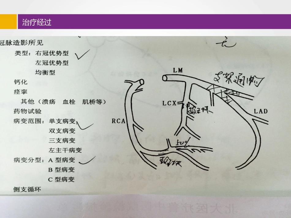 比索洛尔临床应用病例分享_第11页