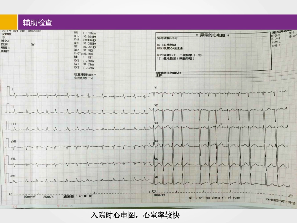 比索洛尔临床应用病例分享_第5页