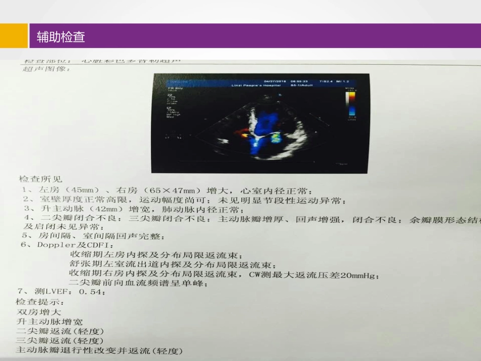 比索洛尔临床应用病例分享_第6页