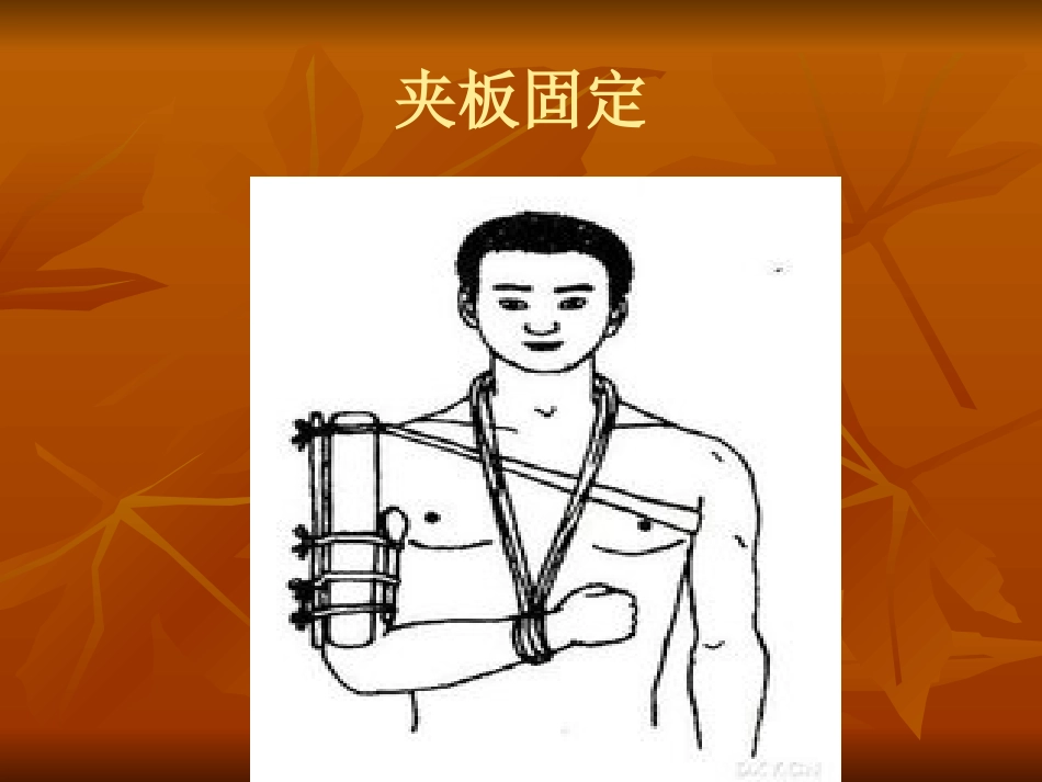 肱骨外科颈骨折中医诊疗方案_第15页