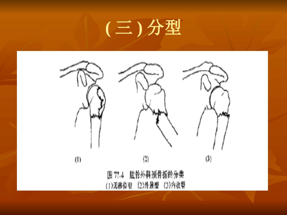 肱骨外科颈骨折中医诊疗方案_第7页