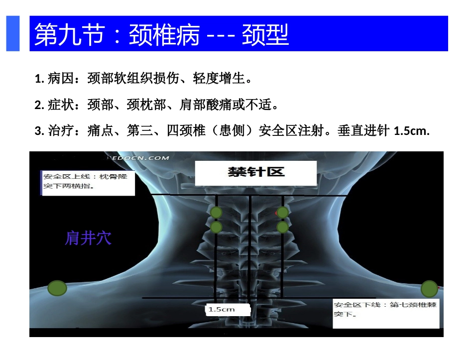 颈肩腰腿痛穴位注射疗法PPT幻灯片_第10页