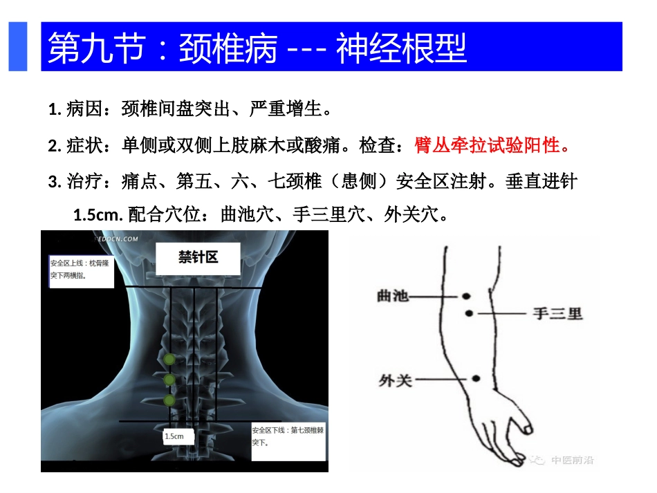 颈肩腰腿痛穴位注射疗法PPT幻灯片_第11页