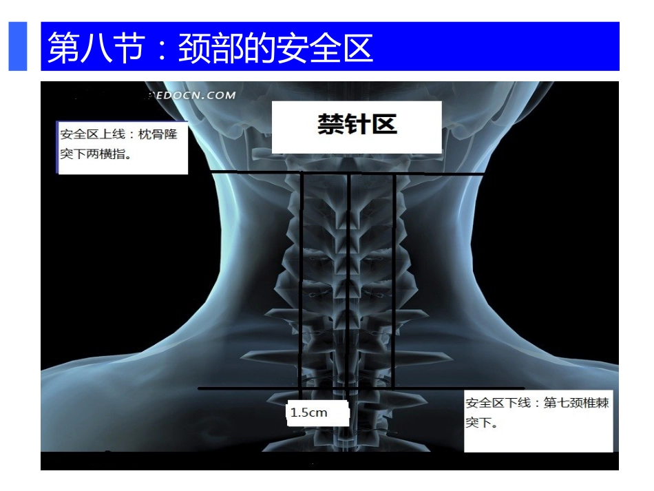 颈肩腰腿痛穴位注射疗法PPT幻灯片_第9页