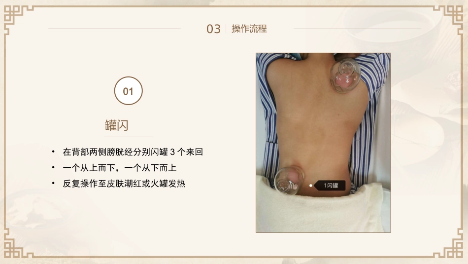 中医治疗：平衡火罐_第12页