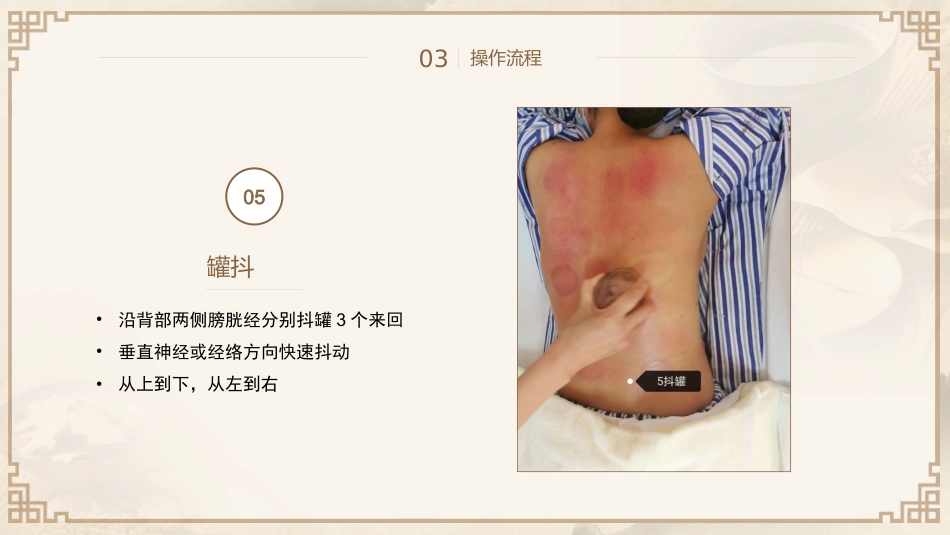 中医治疗：平衡火罐_第15页