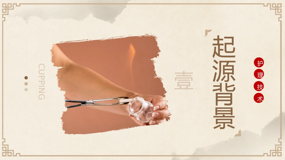 中医治疗：平衡火罐_第3页