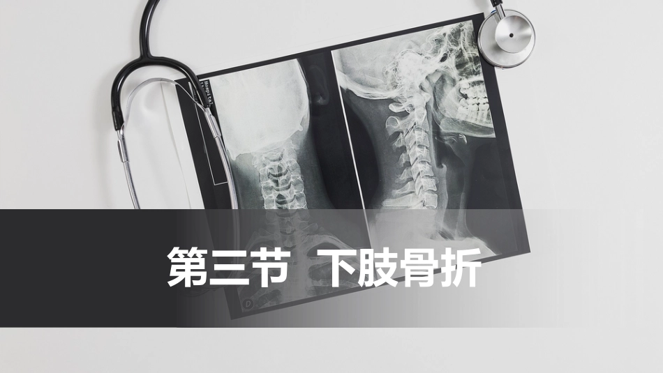 骨折-下肢骨折(中医骨伤科学十三五教材)_第1页