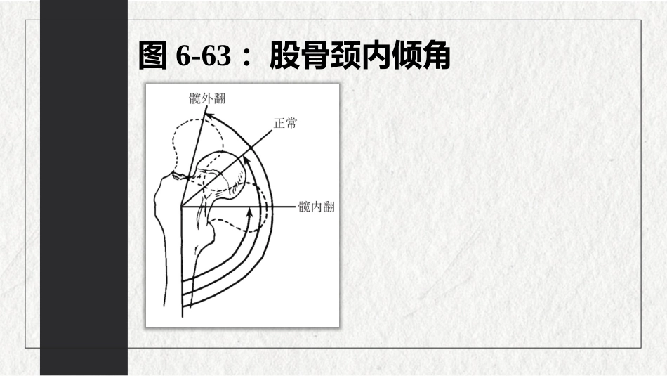 骨折-下肢骨折(中医骨伤科学十三五教材)_第8页