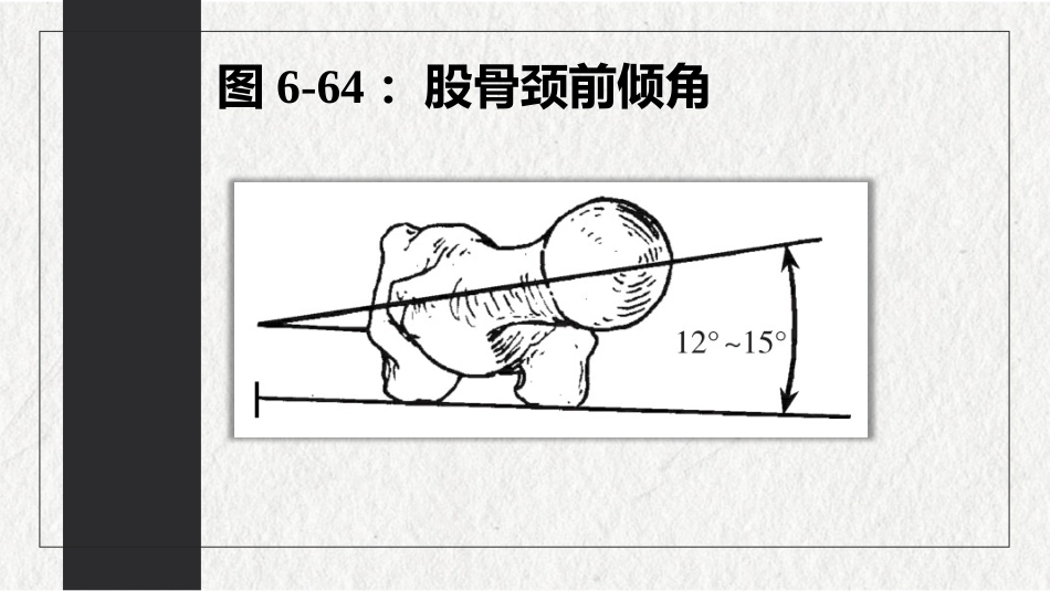 骨折-下肢骨折(中医骨伤科学十三五教材)_第9页