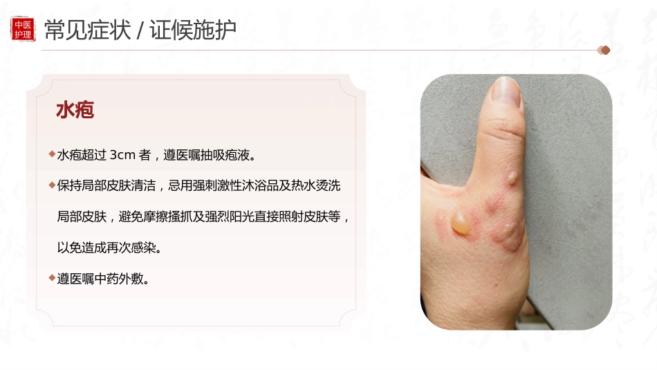 中医护理：丹毒患者的中医护理_第12页