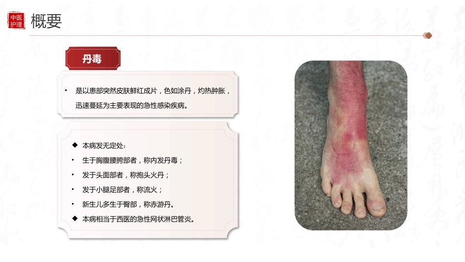 中医护理：丹毒患者的中医护理_第4页